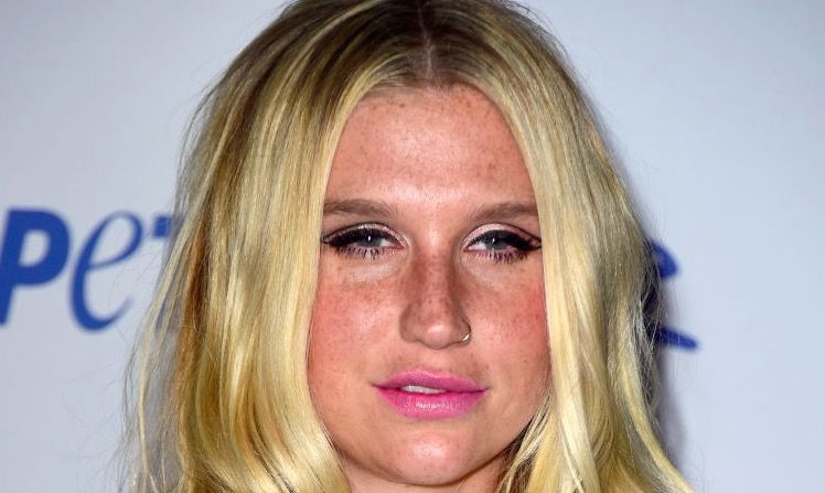 kesha-iq