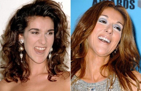 Smeal, Granitz/WireImage