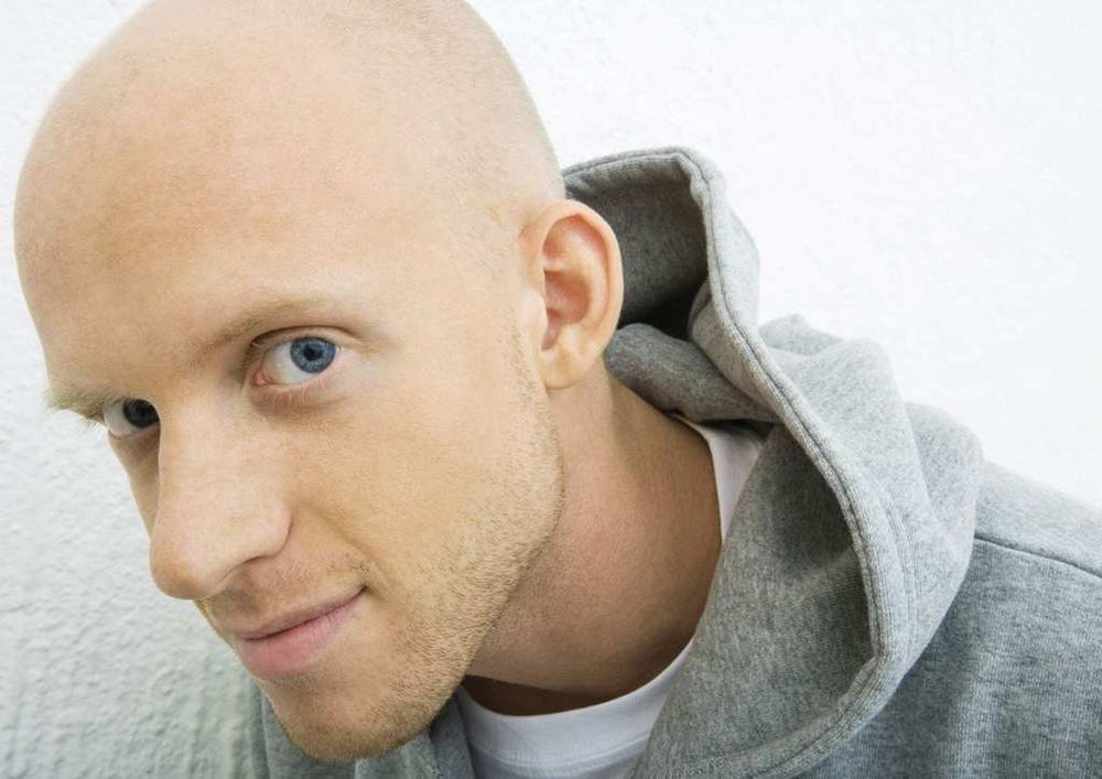 Seoul Researches May Have Finally Found A Cure For Hair Loss