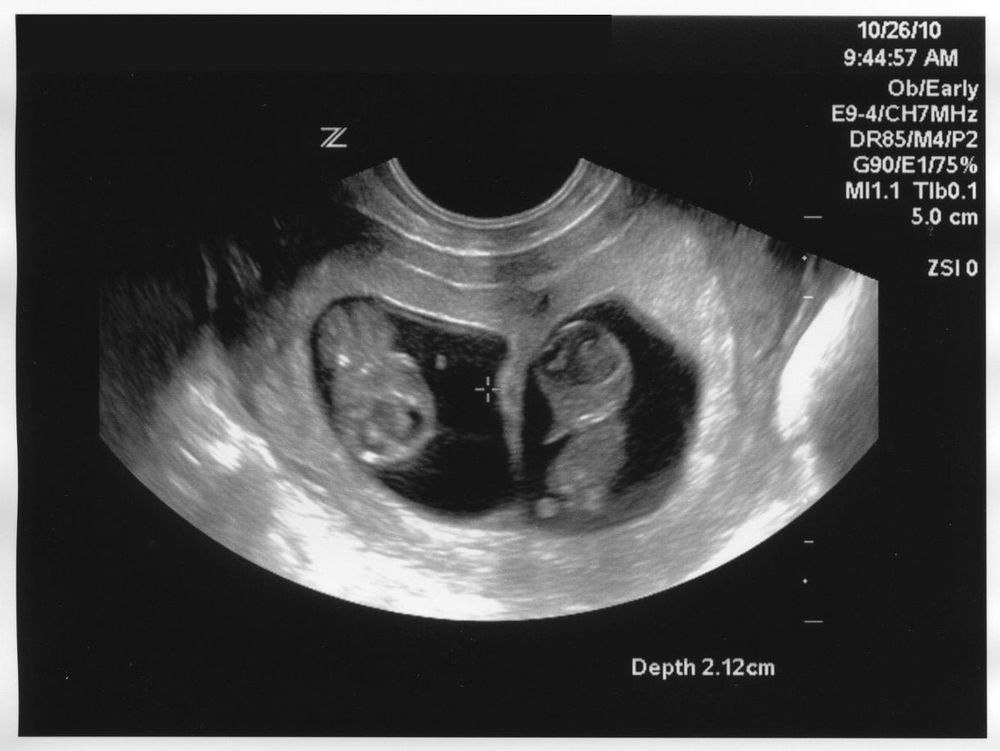 embryo